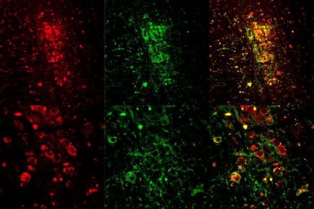 Confocal images show expression of the neurotransmitter, acetylcholine (red), and the light sensitive ion channel, channelrhodopsin (Chr2) (green). The merged images (far right) show neurons expressing both acetylcholine and ChR2 (yellow). The top row displays the entire brainstem; the bottom row shows expression at the cellular level.