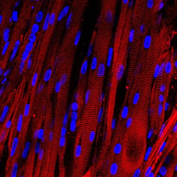 A microscopic view of lab-grown human muscle bundles stained to show patterns made by basic muscle units and their associated proteins (red), which are a hallmark of human muscle.