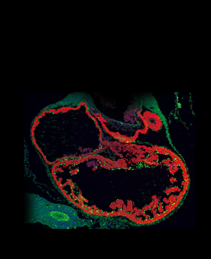 Possible Therapeutic Target for Brain Blood Vessel Disorder