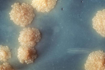 A close-up of a Mycobacterium tuberculosis culture reveals the organism’s colonial morphology. Image: CDC/George Kubica