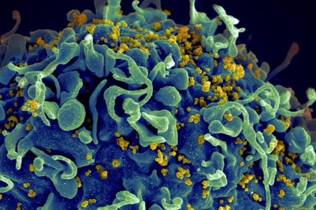 This human T cell (blue) is under attack by HIV (yellow), the virus that causes AIDS. The virus specifically targets T cells, which play a critical role in the body's immune response against invaders like bacteria and viruses. Source: NIH