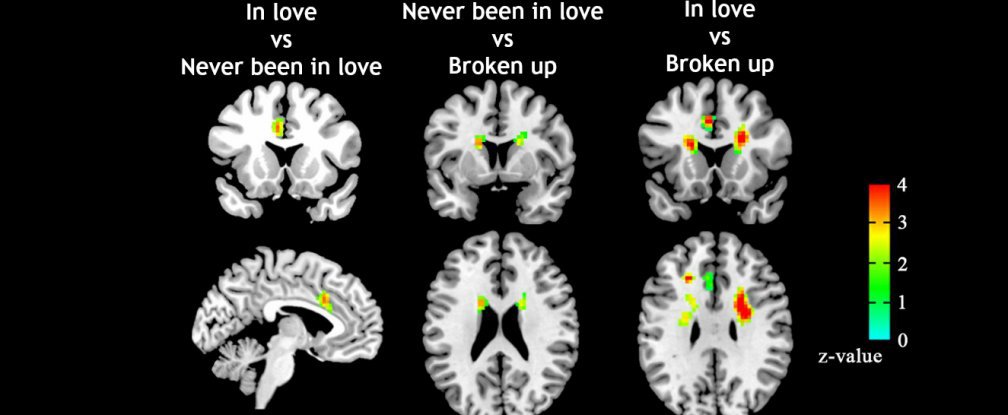 Scientists can now tell if you’re in love by scanning your brain