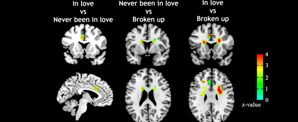 Scientists can now tell if…