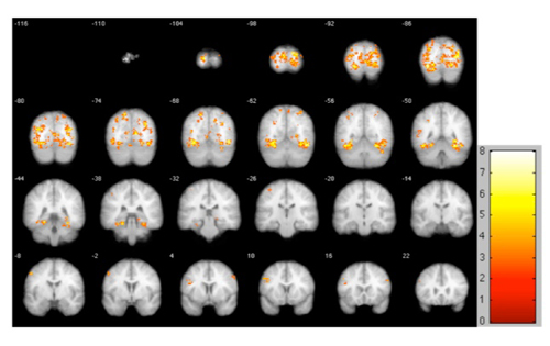 OpenfMRI allows neuroscientists to share…