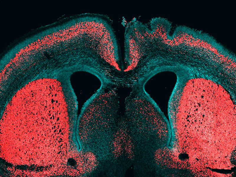 A Gene for Brain Size…