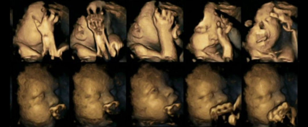 New 4D ultrasound study reveal harmful effects of smoking on foetus
