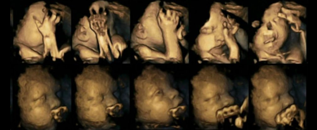 New 4D ultrasound study reveal…