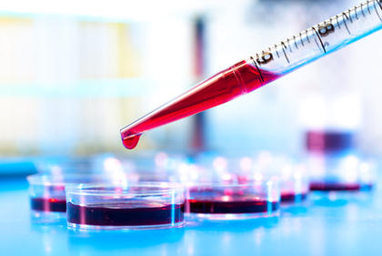 New Blood Test Identifies Past…