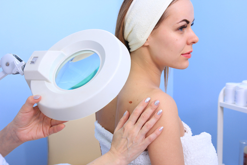 Watch that Tan: Melanoma Rates…