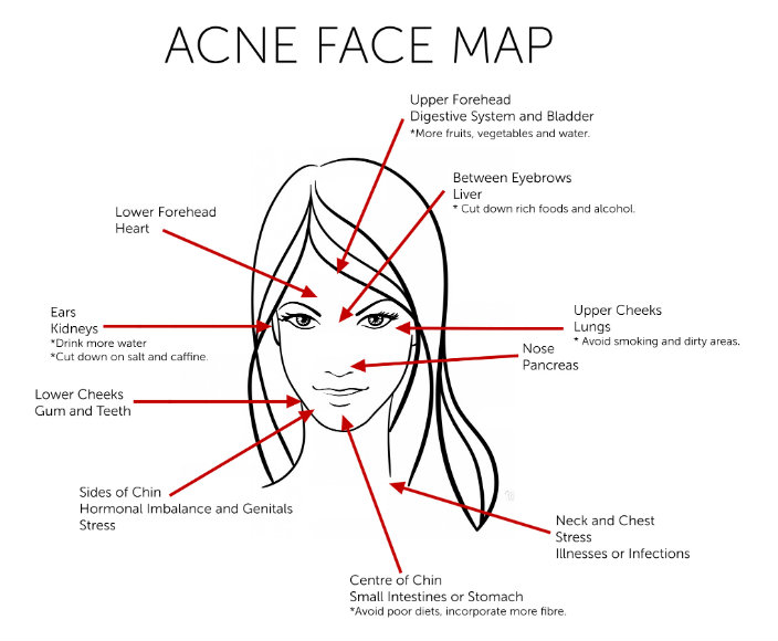 Acne can tell a lot…