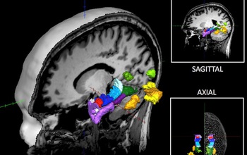 Bold new brain research in…