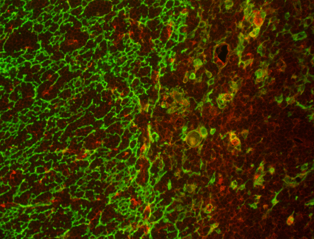 Scientist Shows, How Aging Incapacitate…