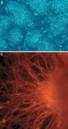 Human embryonic stem cells