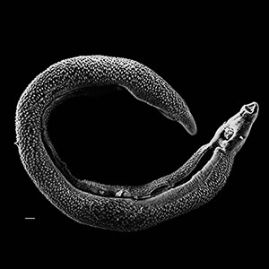 Researchers Find out–Why Parasite Makes&hellip;