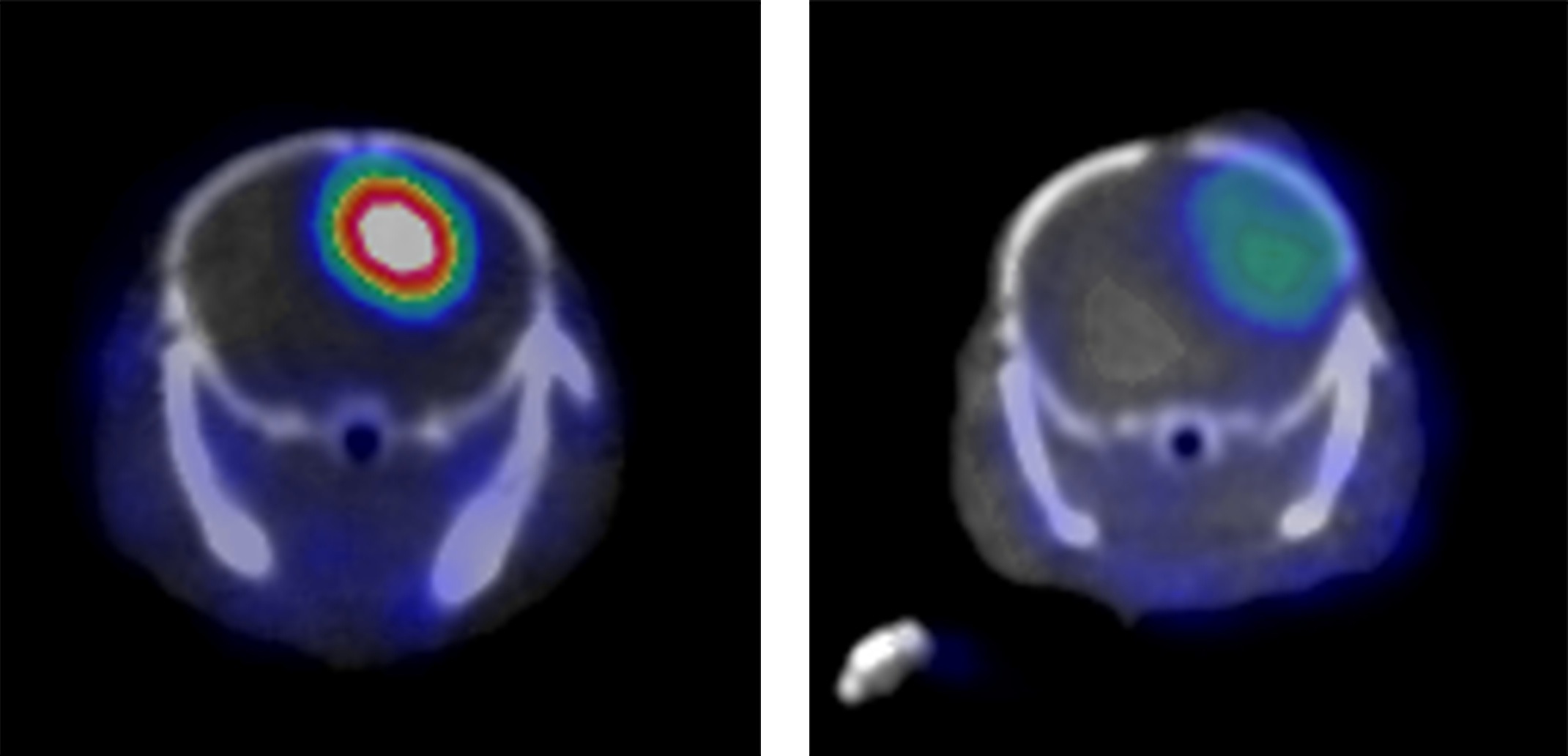 Antibody targets key marker; Opens&hellip;