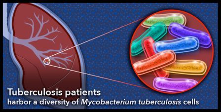 Developing drug resistance may be a matter of diversity for tuberculosis