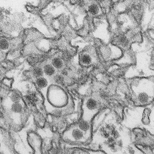 UW-Madison researchers find Zika virus…