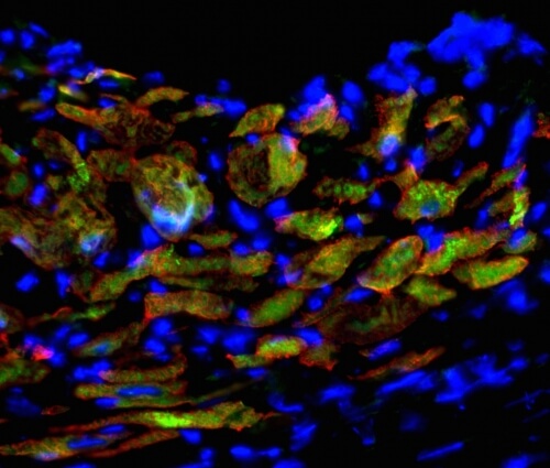 Wisconsin researchers transform common cell…