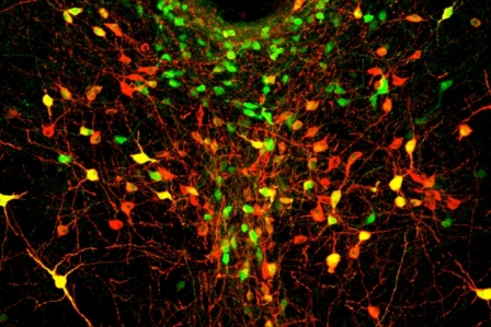 bt1602 MIT Lonely Neurons