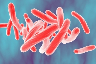 Blood Test Could Transform Tuberculosis Diagnosis
