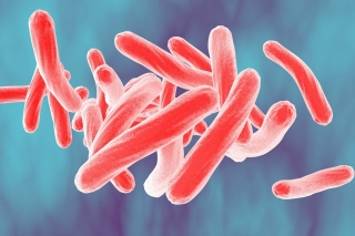 Blood Test Could Transform Tuberculosis…