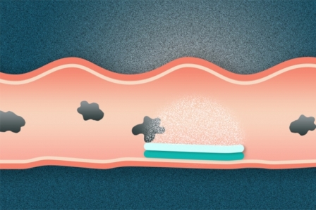 Engineers develop a pill for…