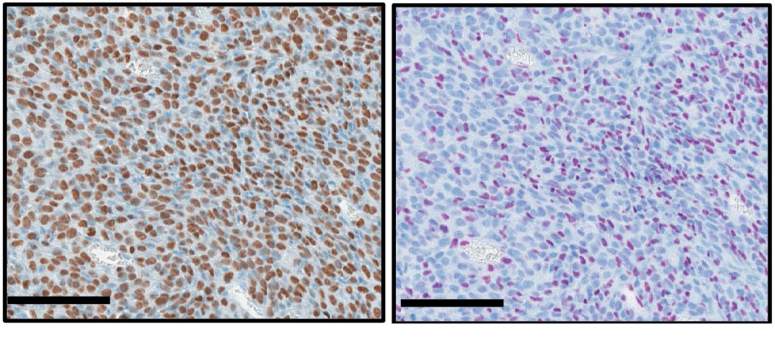Gene regulatory mutation linked to…