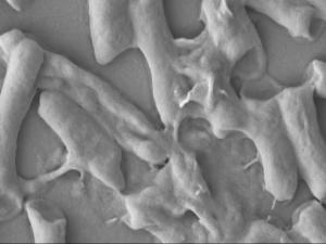 New Material Kills E. Coli…