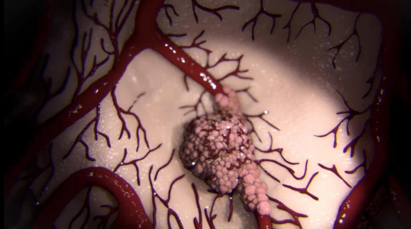Surprising Findings Reveal How Cancer…