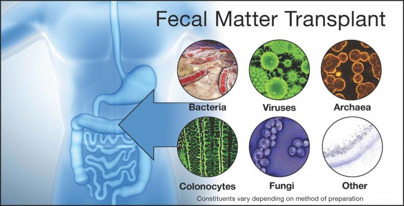 These Days Fecal Transplantation is…