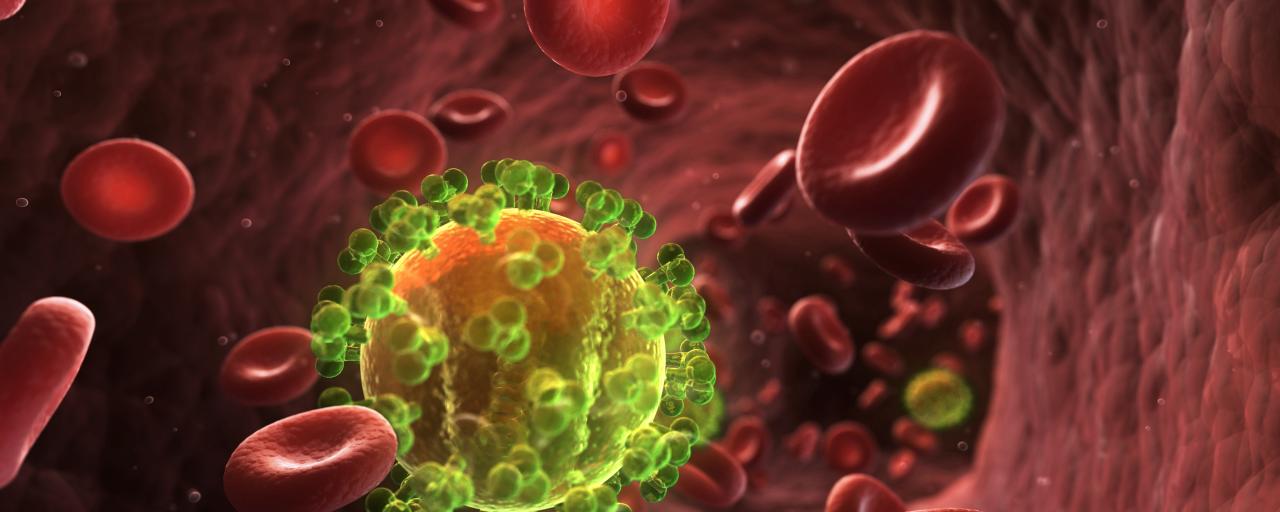 Larger-Scale HIV Vaccine Trial to…