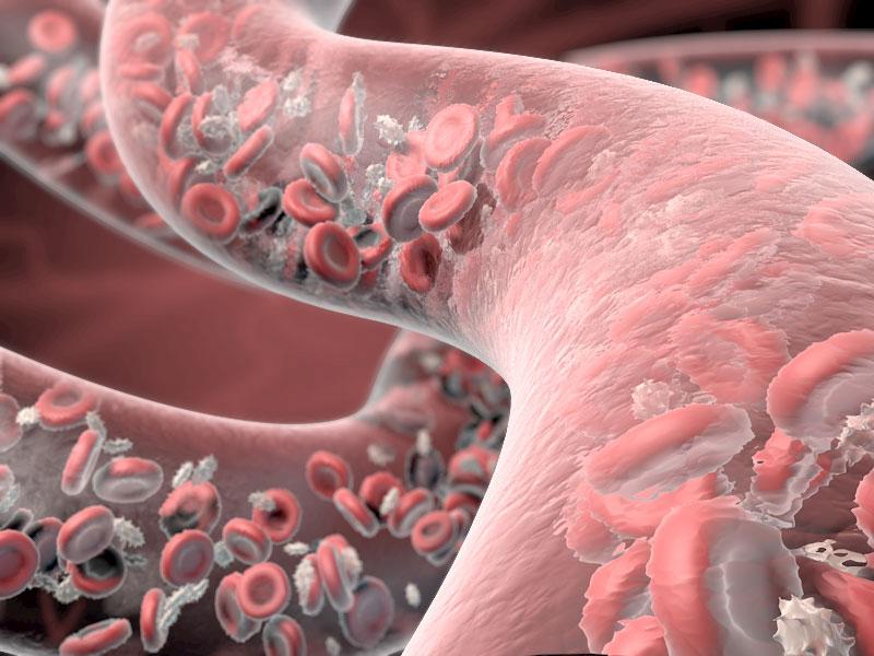 Researchers Develop ‘Reversible’ Blood Thinner