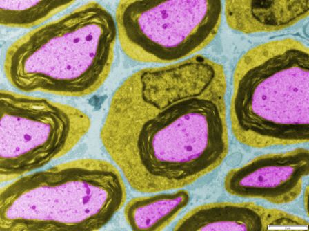 svaren nerve growth