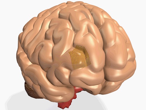 Gentle sensors for diagnosing brain disorders