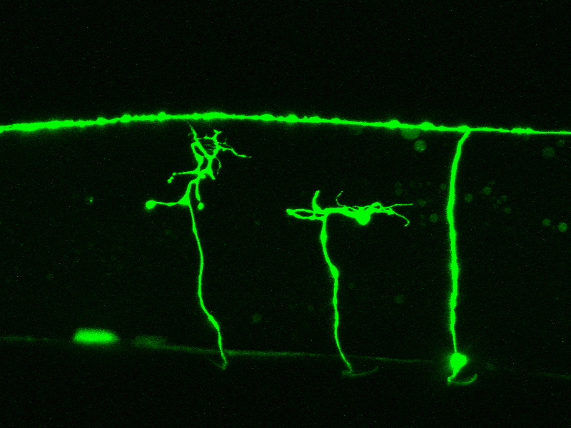 Unraveling Roundworm Nerve Regeneration Mechanism Could Aid Nerve…