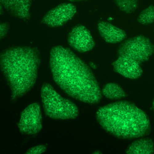 ATF iPS cells