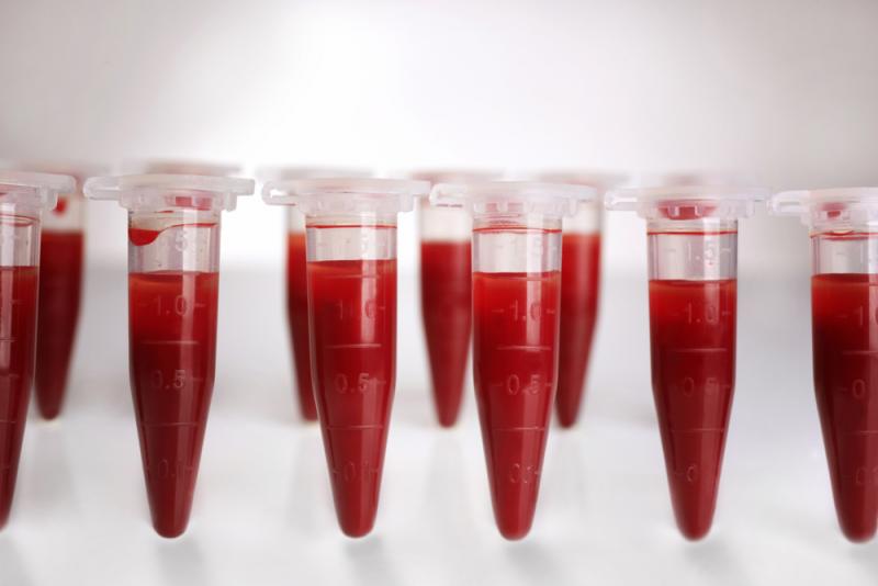 Routine Blood Test Predicts How…