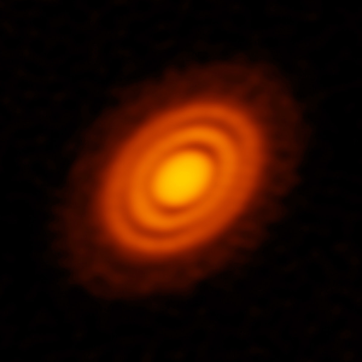 Rings around young star suggest planet formation in progress
