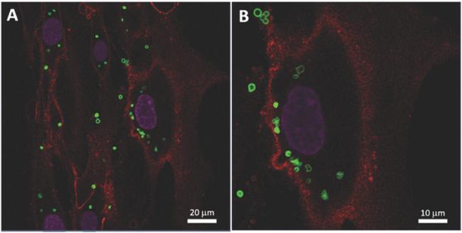 Magnetic Stem Cells for Gene…