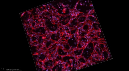 Spinoff readies stem cells for…