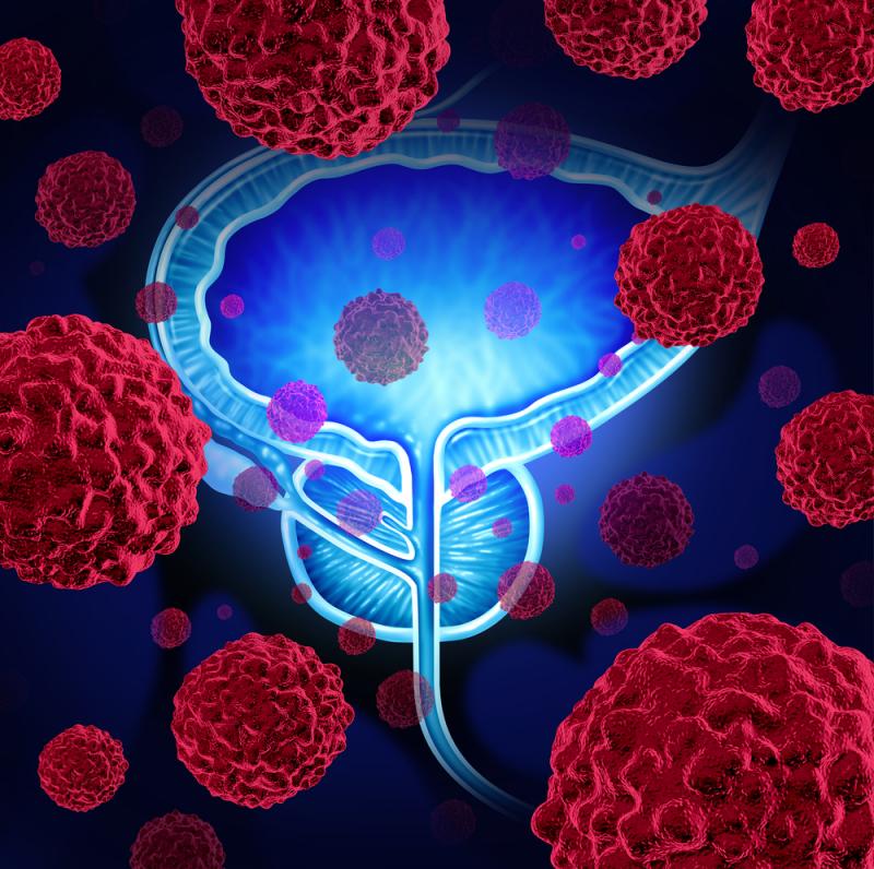 Scientists Uncover New Way to Defeat Therapy-Resistant Prostate…