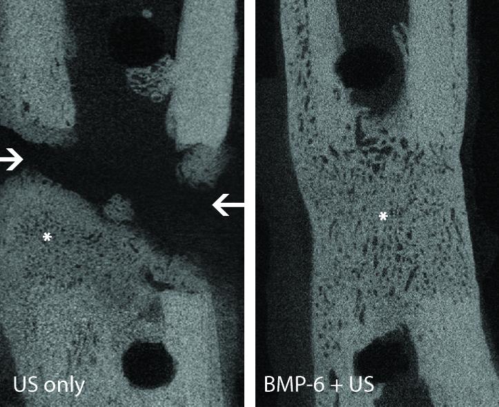 Microbubbles and Gene Therapy Help…