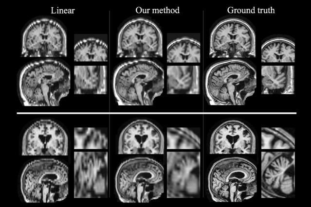 New technique makes brain scans…