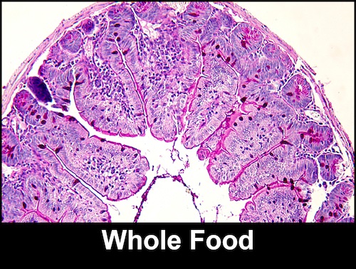 Plant derivative could help patients reliant on tube feeding