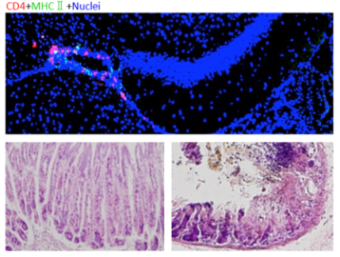 Chronic stress induces fatal organ…