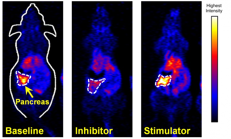 New measure of insulin-making cells…