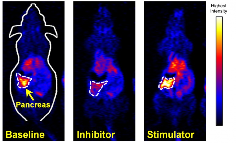 PET scans