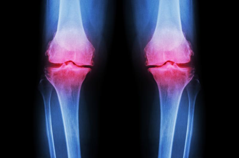 Old Bones Provide New Insights…