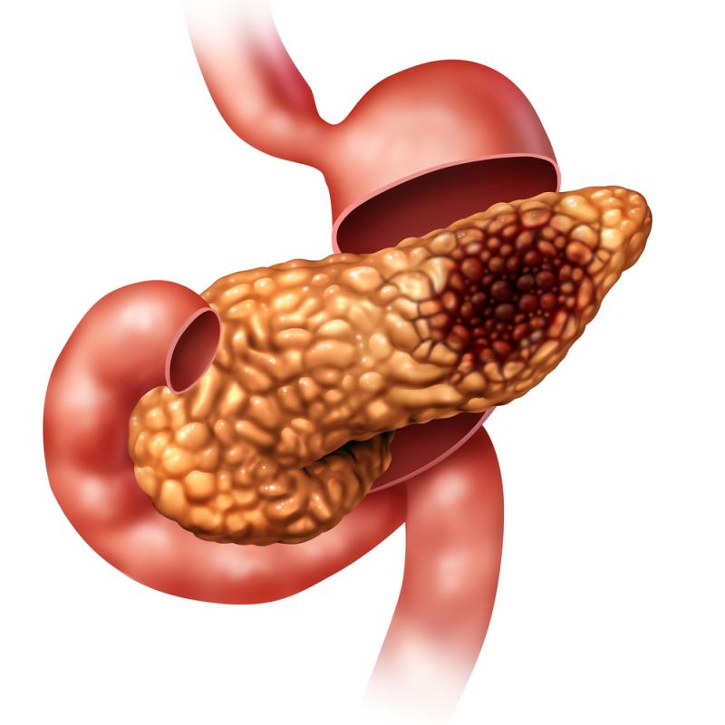 Erytech Unveils New Data for…