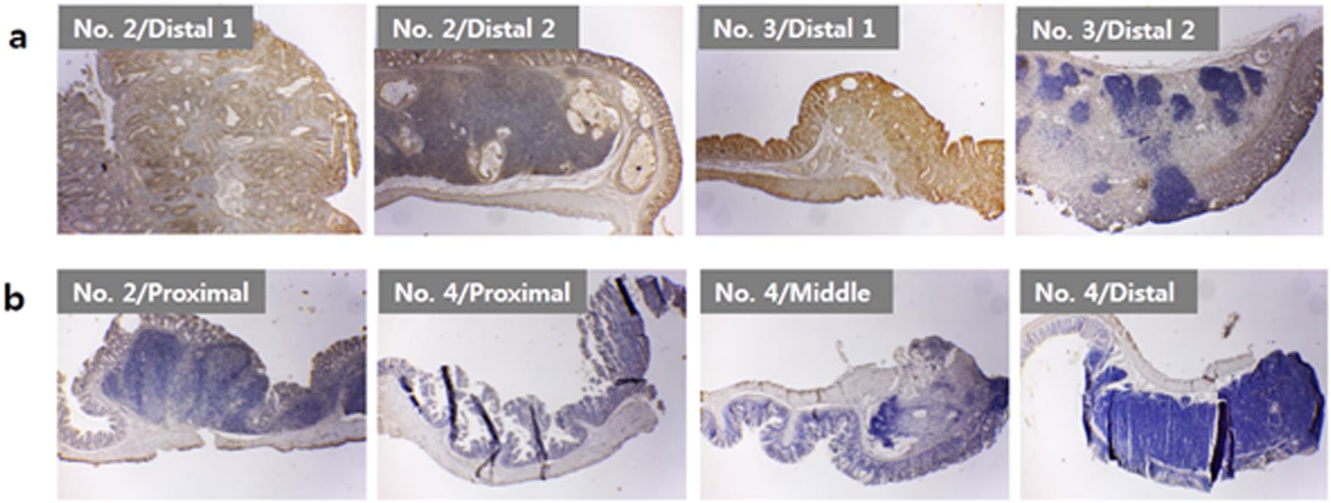 Potential Cancer Treatment Breakthrough with Nanoporous Acupuncture Needles